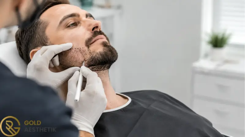 Für wen ist eine Barttransplantation geeignet? Barttransplantation für Personen mit dünnem, asymmetrischem Bart oder Narben