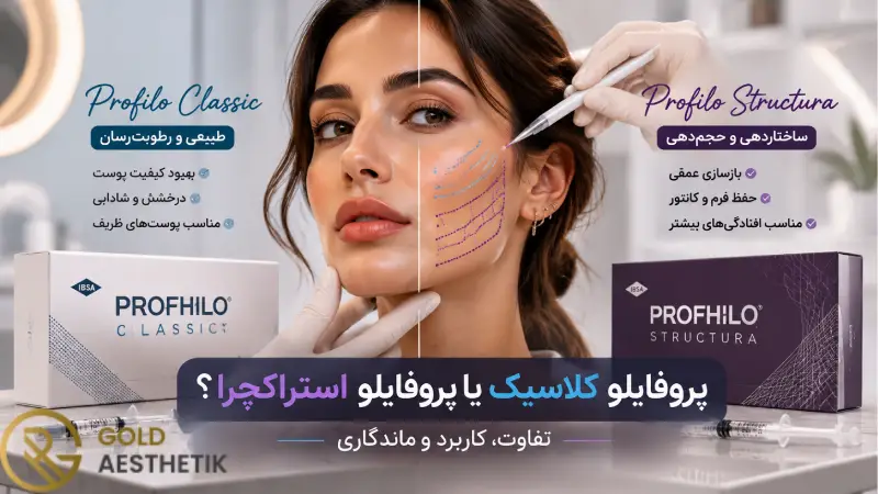 پروفایلو کلاسیک یا پروفایلو استراکچرا؟ | تفاوت، کاربرد و ماندگاری