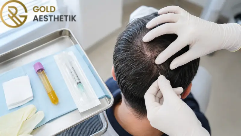 عوامل موثر بر نتیجه PRP مو و تعداد جلسات درمان