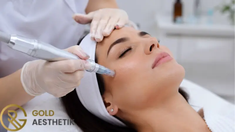 Nachsorge nach Microneedling | Was sollten Sie nicht tun? 2 Was Sie nach Microneedling nicht tun sollten