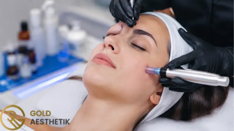 Nachsorge nach Microneedling | Was sollten Sie nicht tun? 1 Warum die Nachsorge nach Microneedling wichtig ist, um Hautreizungen zu reduzieren