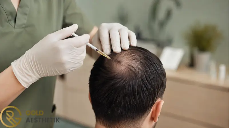 چه کسانی از مزوتراپی برای ریزش مو نتیجه بهتری می گیرند؟